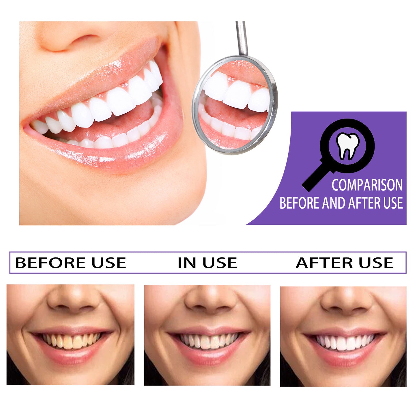 Blanchiment des dents dentifrice blanchiment des dents