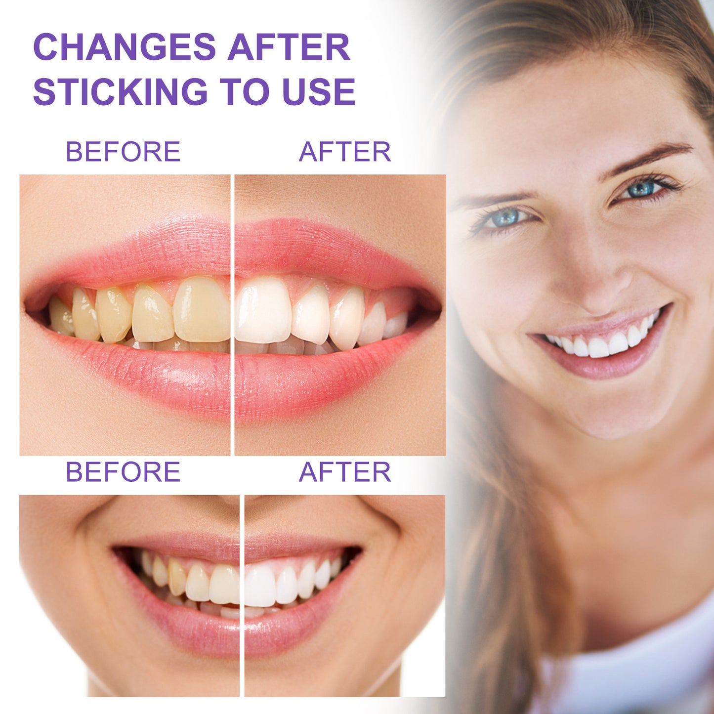 Blanchiment des dents dentifrice blanchiment des dents